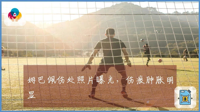 姆巴佩伤处照片曝光，伤痕肿胀明显